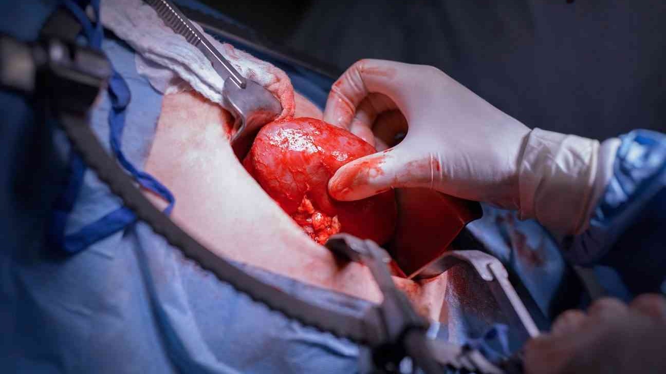 operacija-peresadka-transplantacija-pochki-nii-urologii-lopatkina-2-kopija-1620x1080-Cropped.jpg